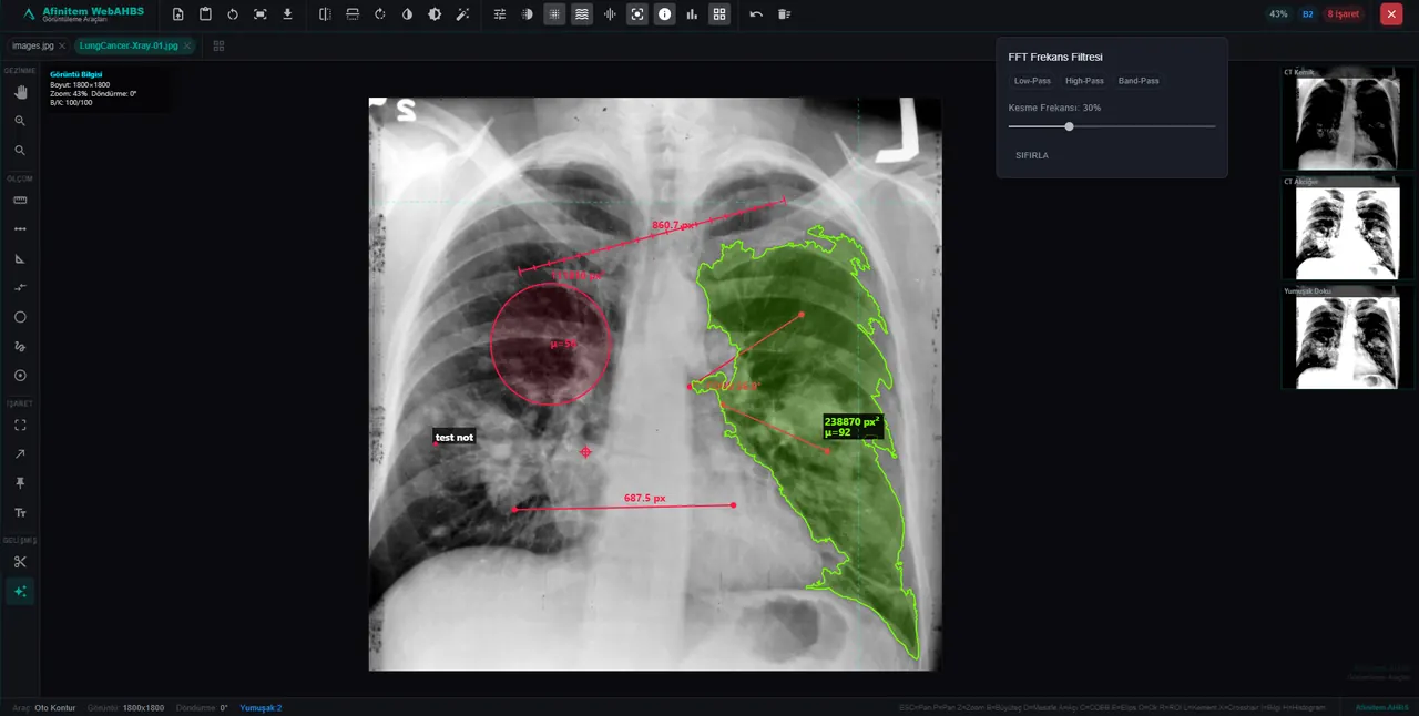 Vizualizare radiologică